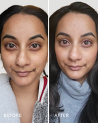 Before and after comparison of a woman’s face showing improved skin texture and reduced dark circles using Dream Bio-Retinol + Shorea Butter Rejuvenating Cream | Three Ships in a natural skincare routine.